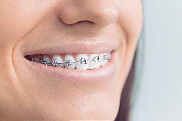 Trusted Flordell Hills, MO Holistic Dental Care Services Experts